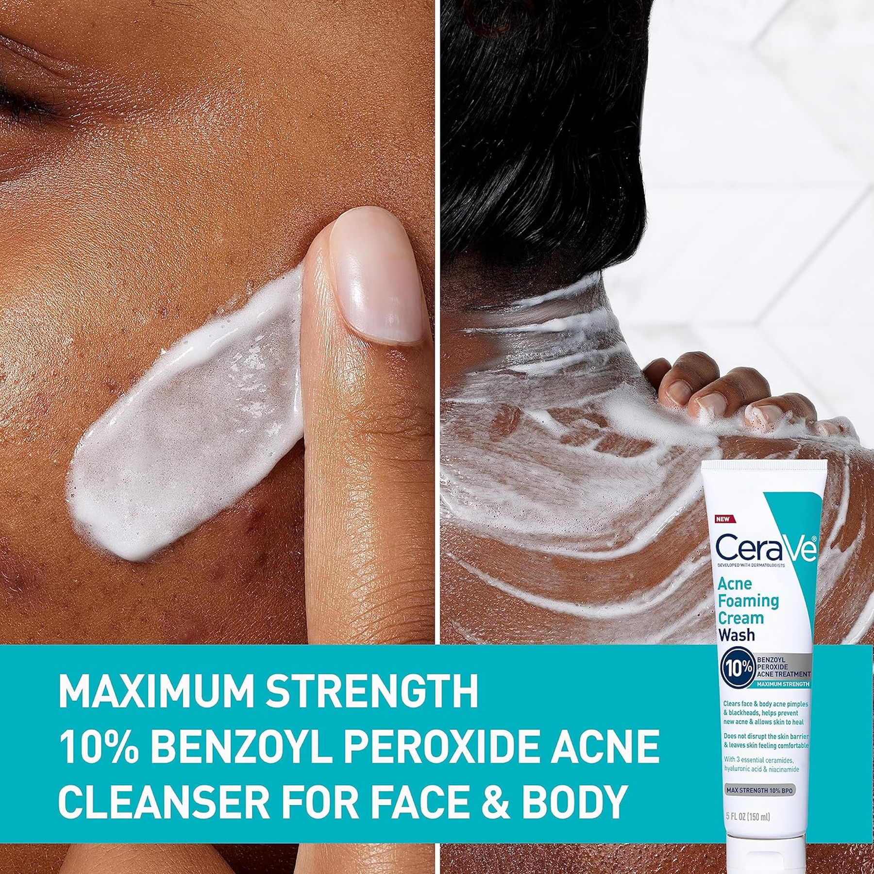 Cerave Acne Foaming Cream Wash 10% Benzoyl Peroxide Acne Treatment - 150ml - 画像 (3)